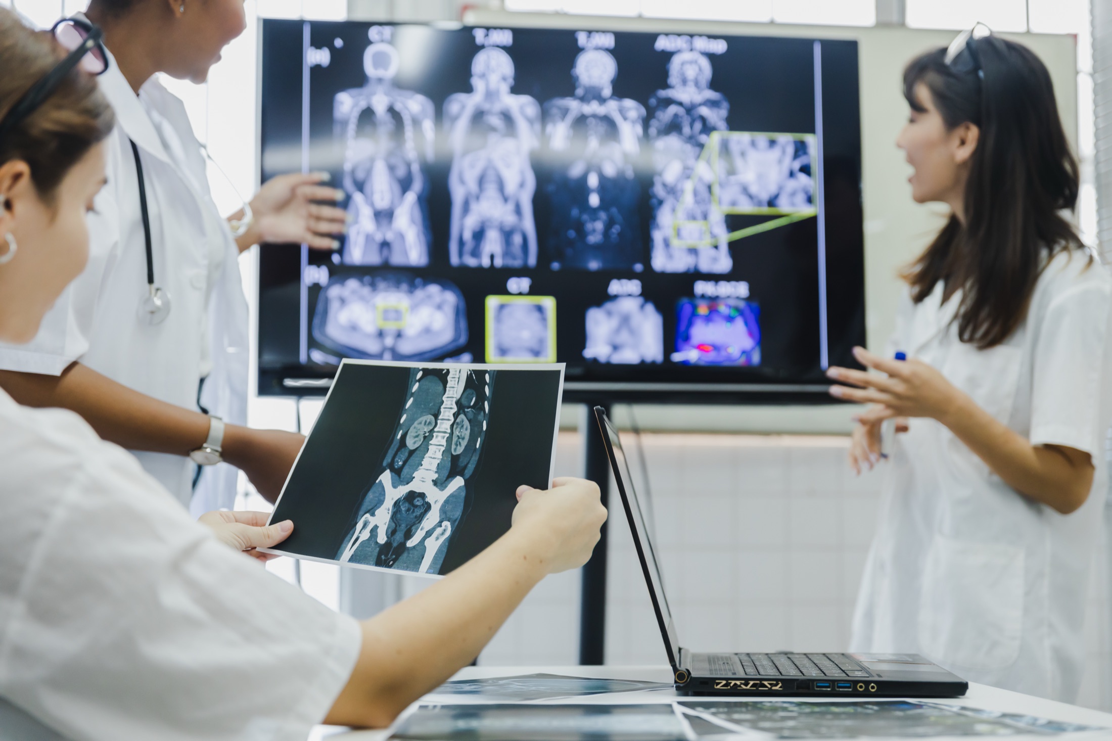 Especialistas de atención médica revisando juntos exploraciones de diagnóstico